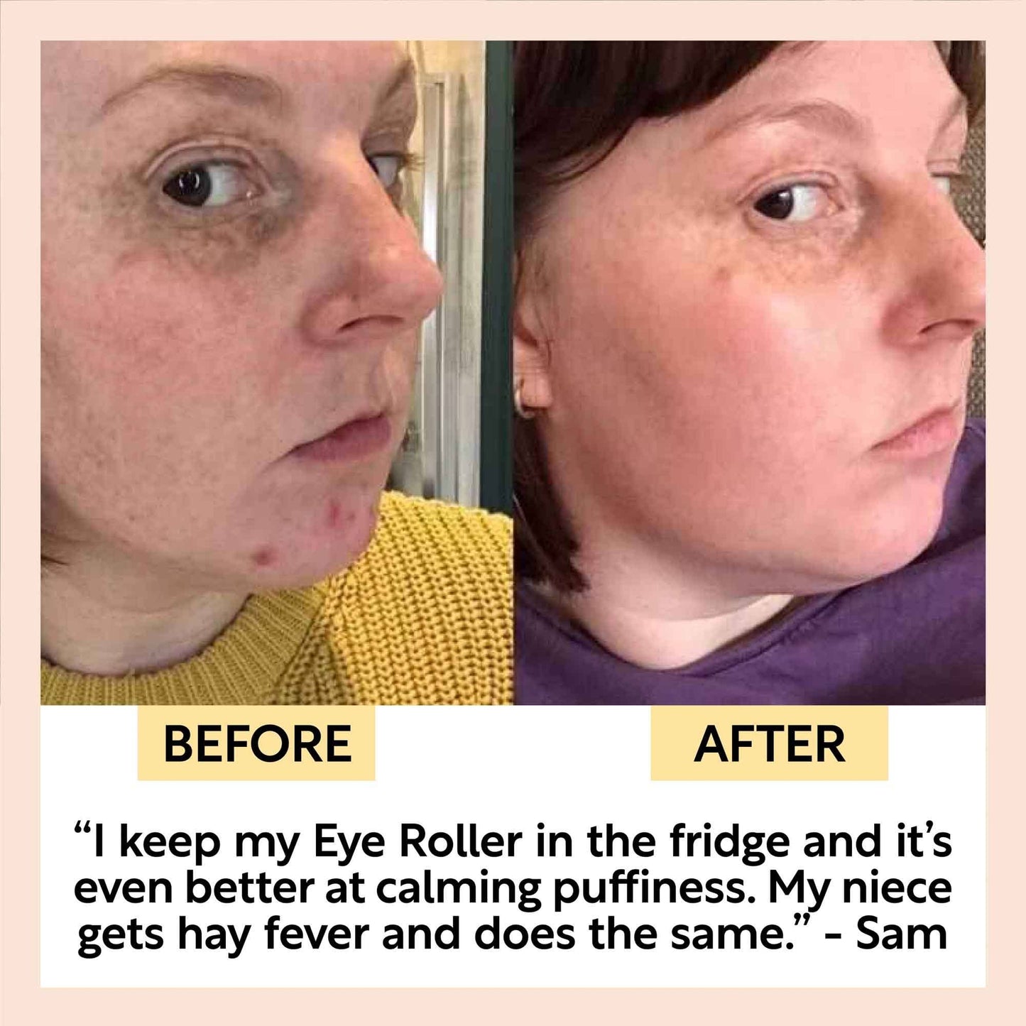 UpCircle | Eye Roller